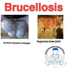 Brucellosis