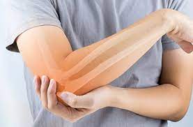 Elbow Injuries