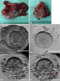 Vitro Maturatio