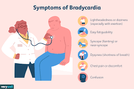 bradycardia heartbeat