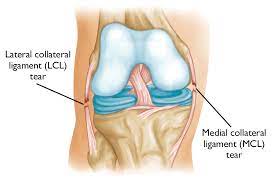 Knee Injuries