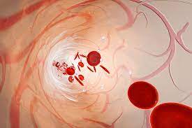 Diagnose and treat certain blood diseases