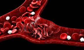 Diagnose and treat certain blood diseases