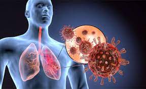 Respiratory Dysfunction